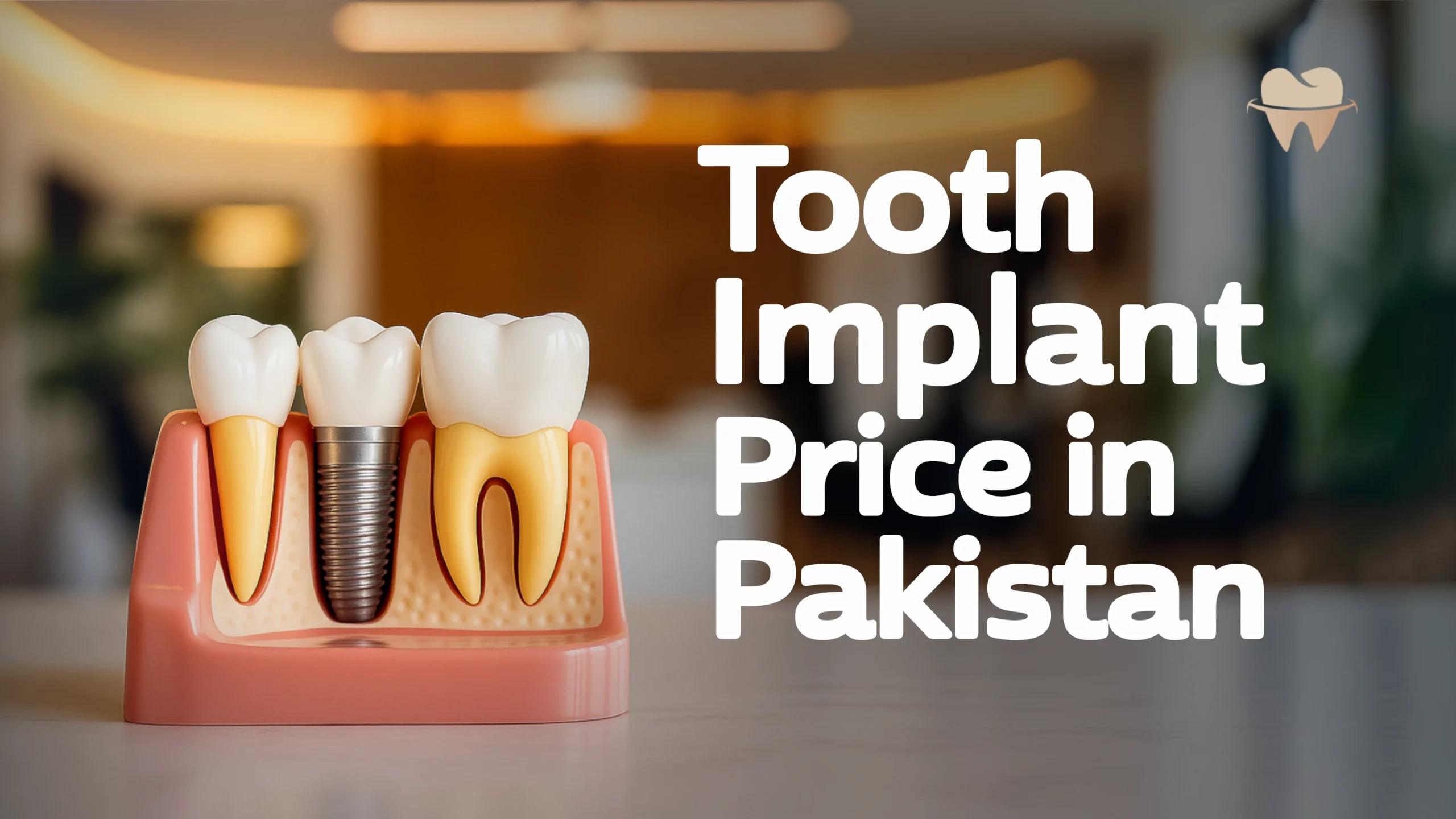 Tooth Implant Price in Pakistan in 2025 - An Overview