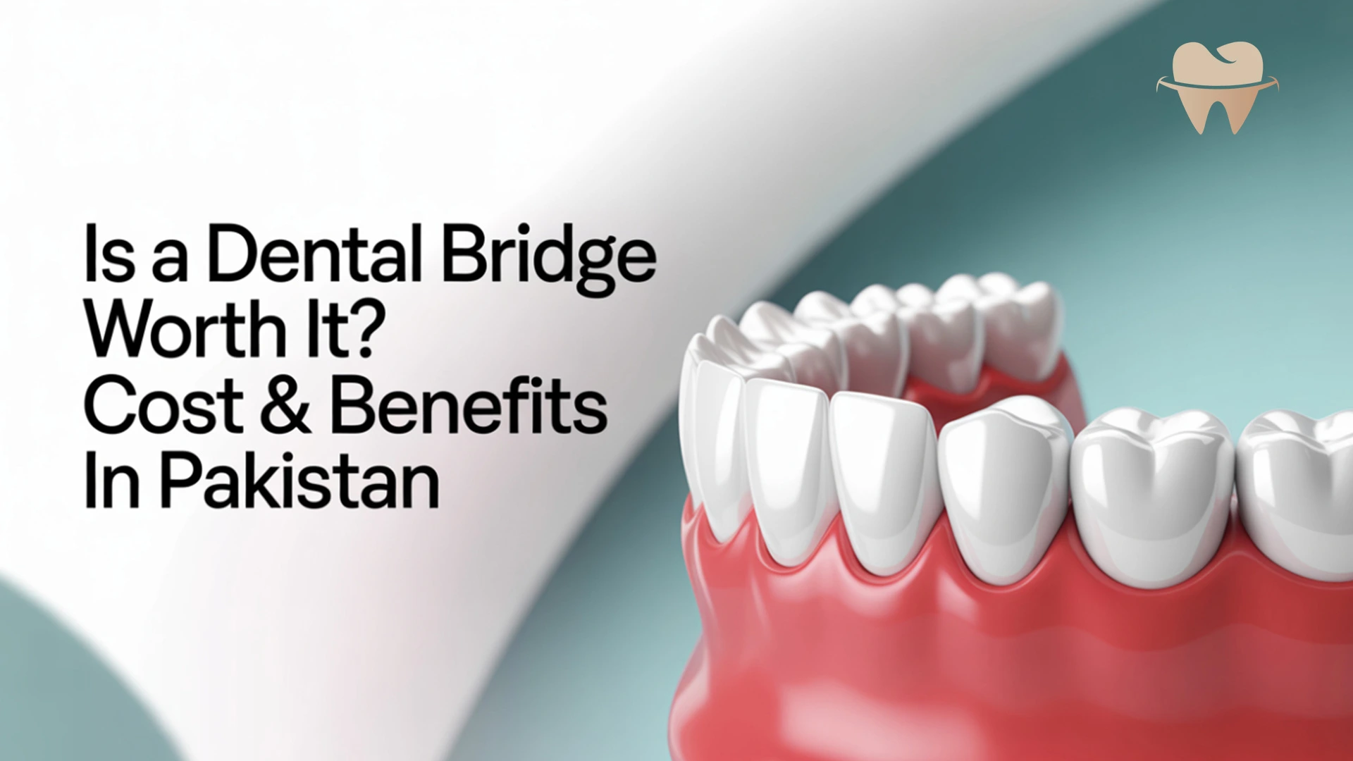 Dental Bridge Cost & Benefits in Pakistan in 2025