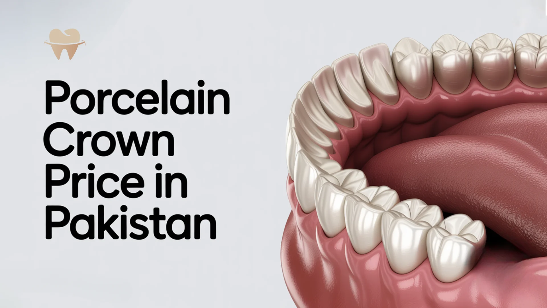 Porcelain Crown Price in Pakistan – Updated Cost Guide