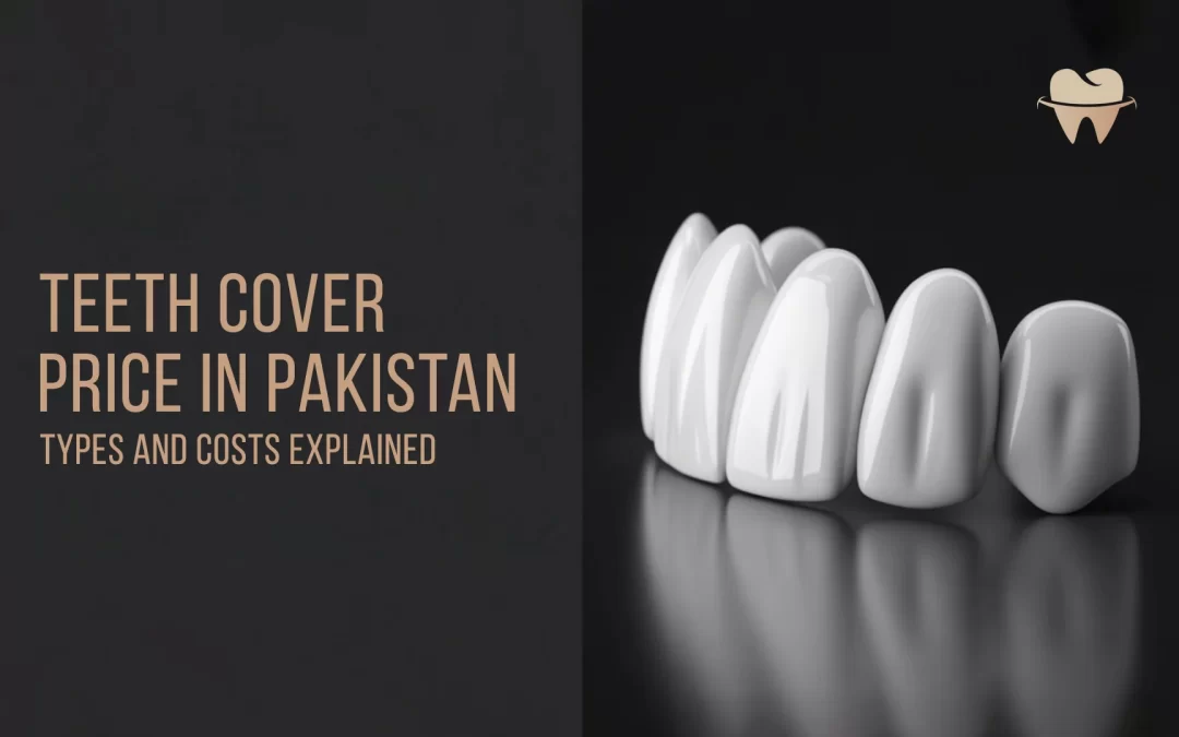Teeth Cover Price in Pakistan: Types and Costs Explained