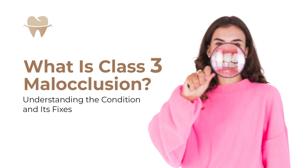 What Is Class 3 Malocclusion? Understanding the Condition and Its Fixes
