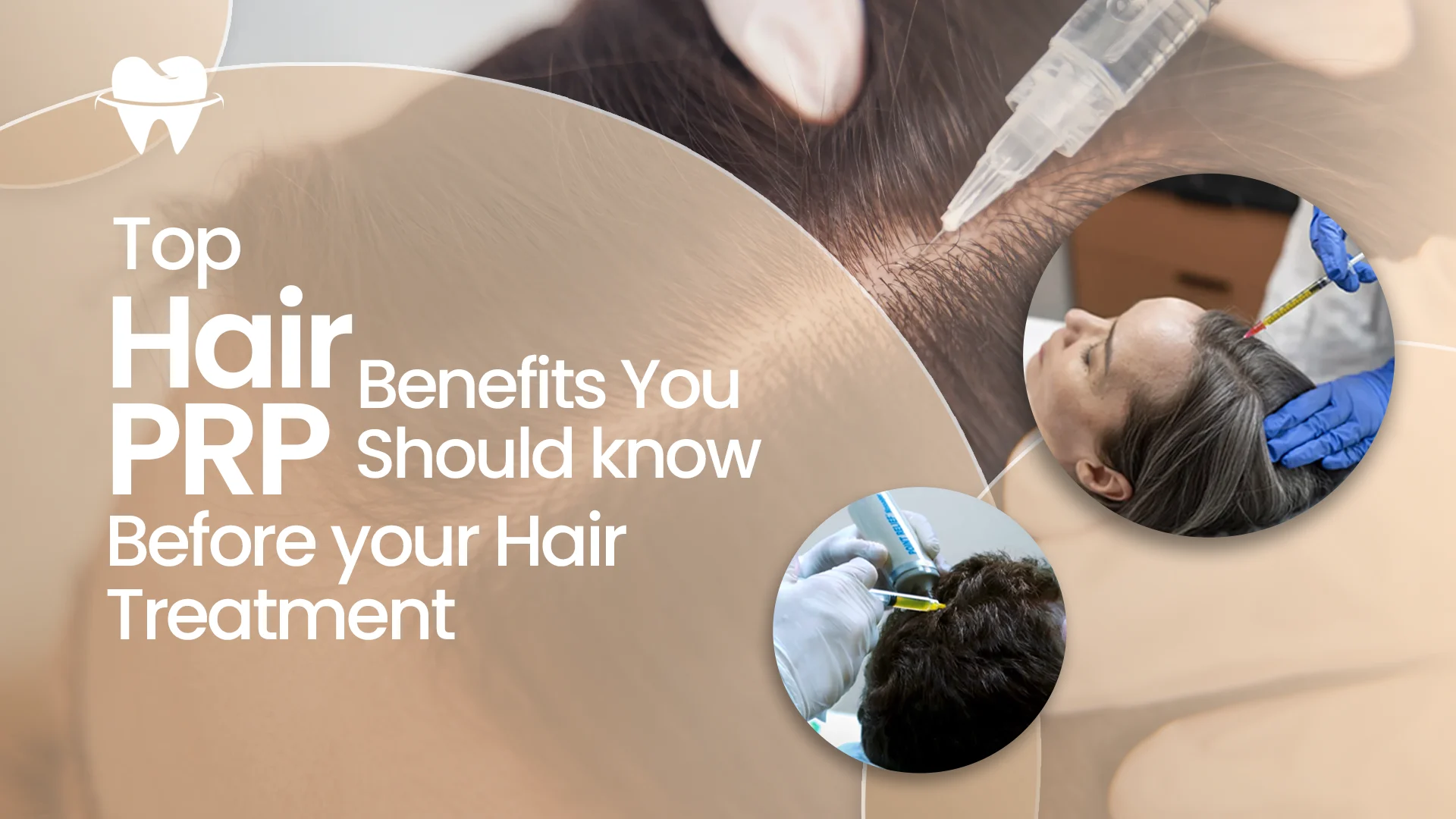 Hair PRP Benefits