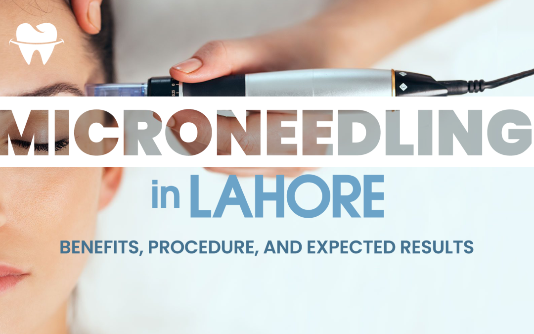 Microneedling in Lahore: Benefits, Procedure, and Expected Results