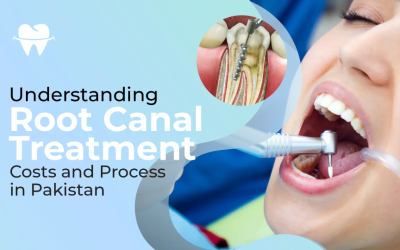 Understanding Root Canal Treatment Costs and Process in Pakistan