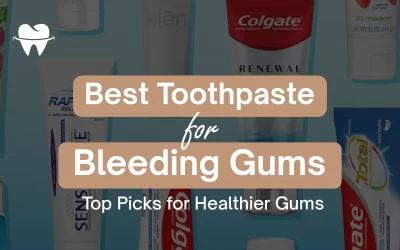 Best Toothpaste for Bleeding Gums: Top Picks for Healthier Gums