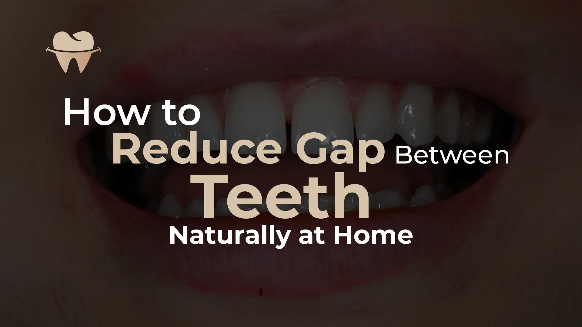 How to Reduce the Gap Between Teeth Naturally at Home