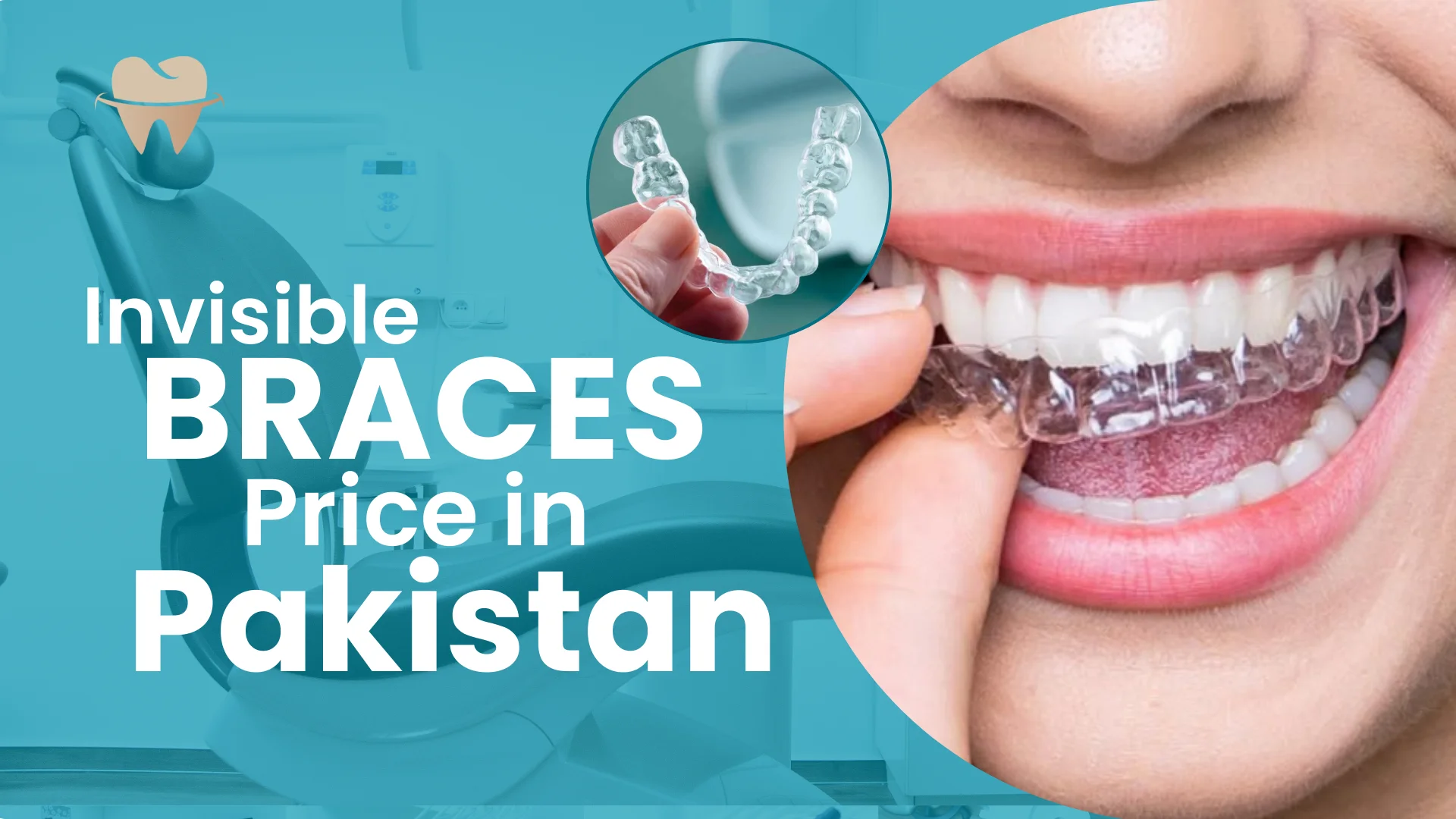 Invisible Braces Price in Pakistan