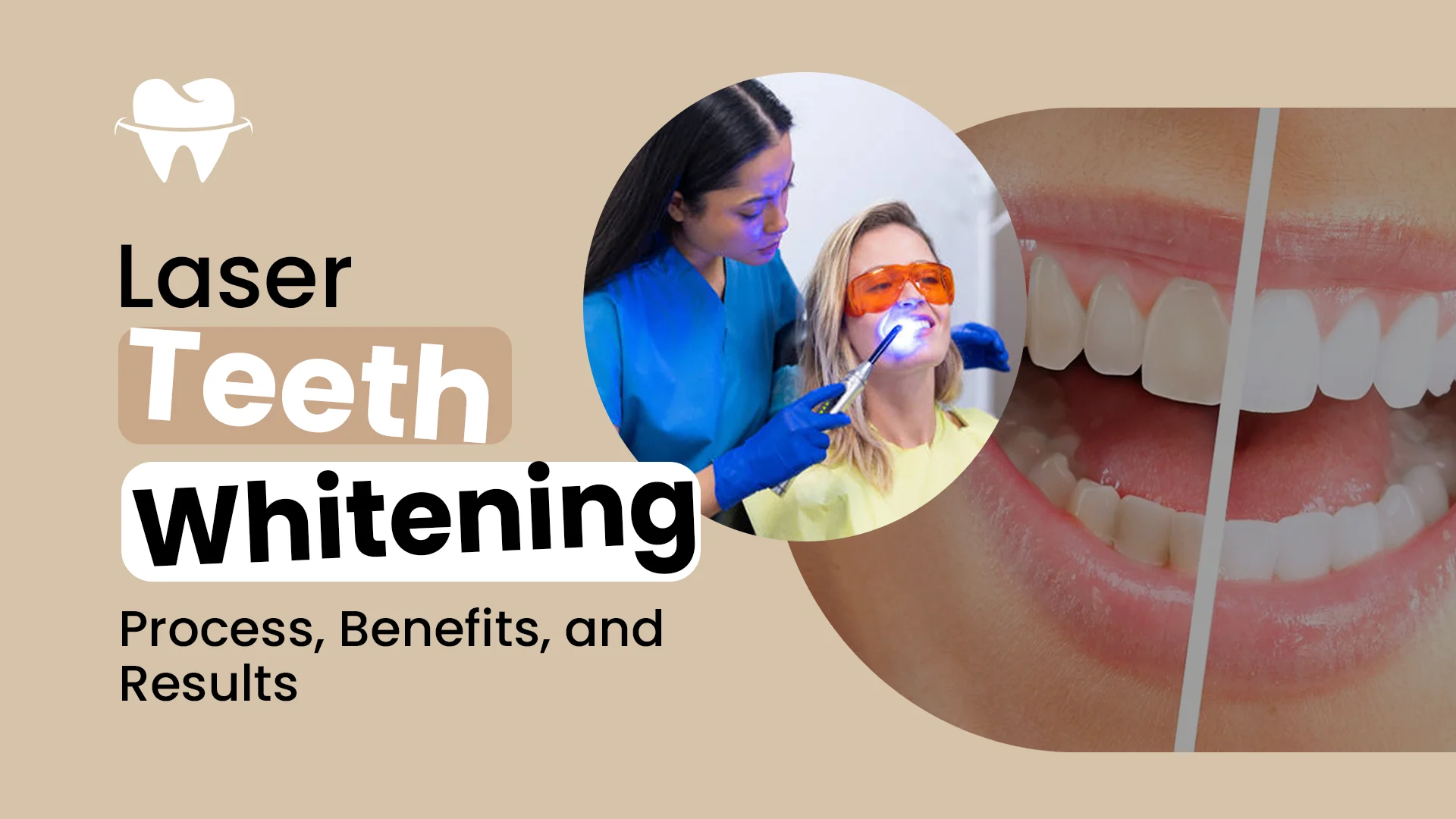 Laser Teeth Whitening