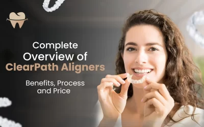 Complete Overview of Clear Path Aligners Benefits, Process and Price
