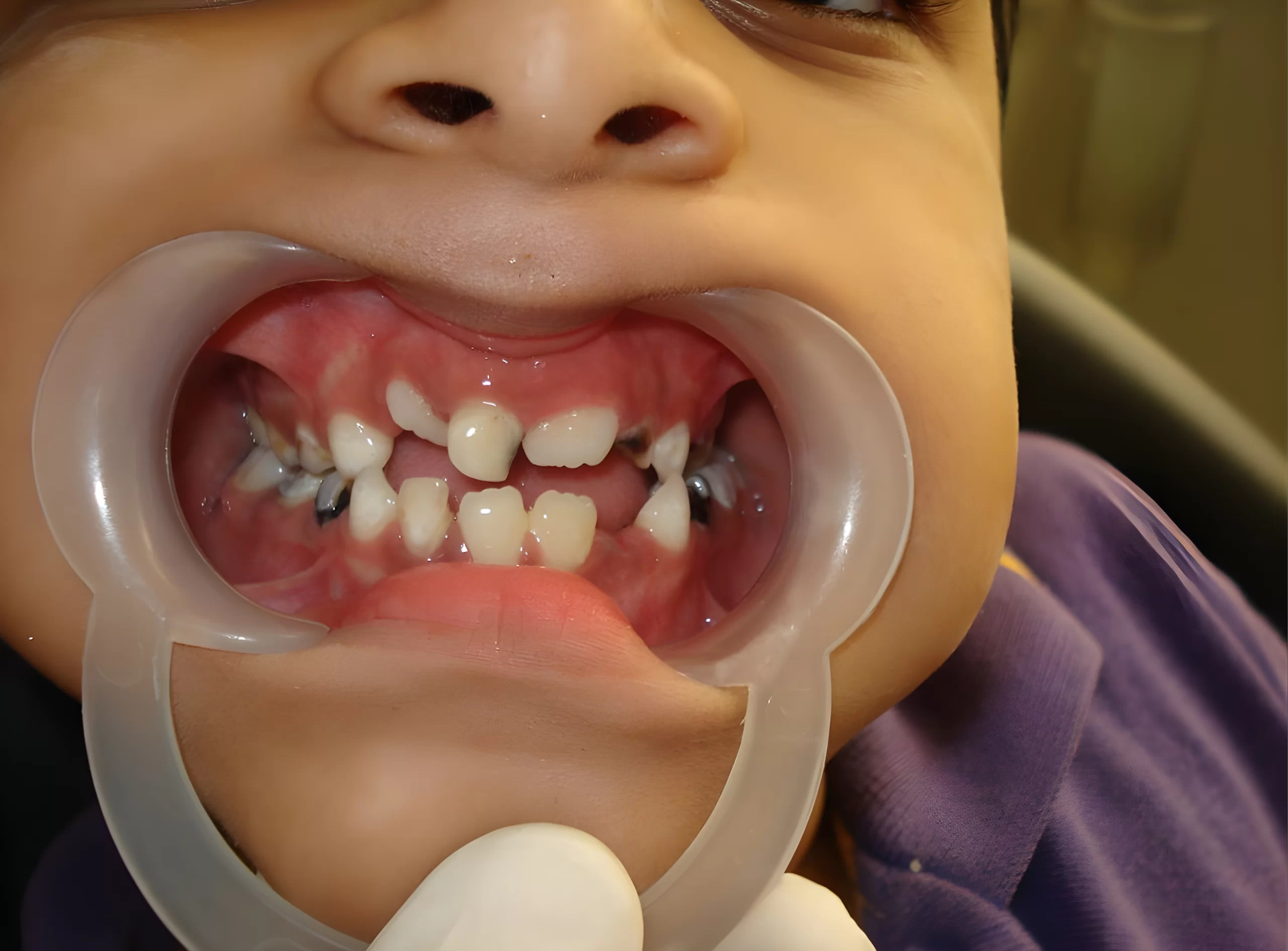 When Should Your Child See a Pediatric Dentist