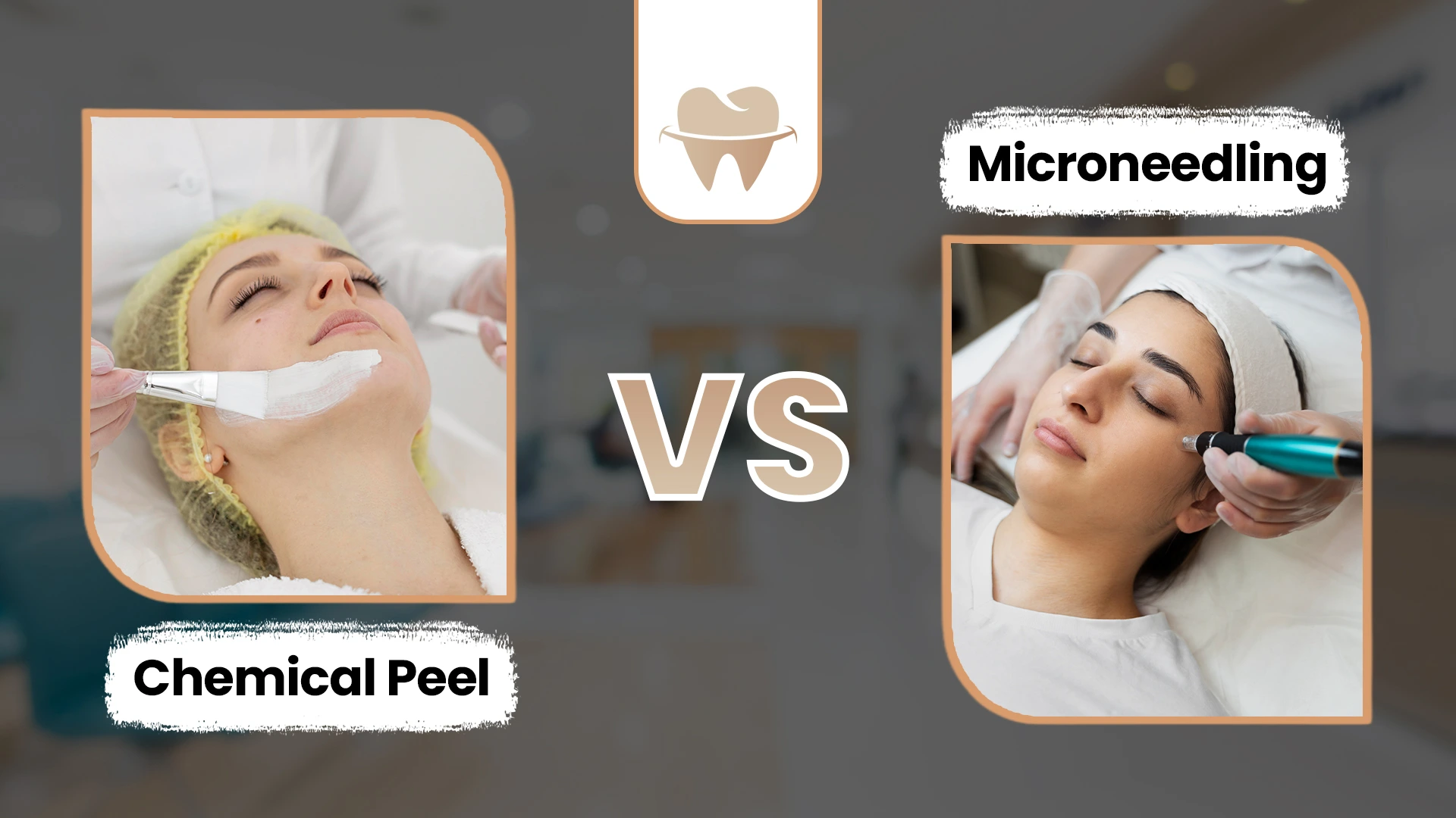microneedling vs chemical peel