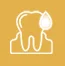 Bleeding Gums 