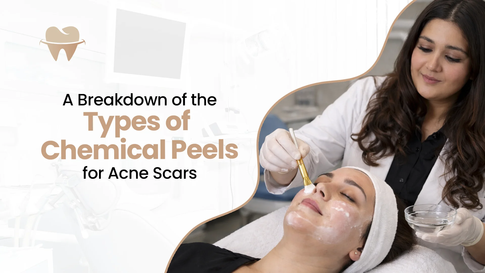 Types of Chemical Peels for Acne Scars
