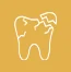 Damaged or Broken Teeth