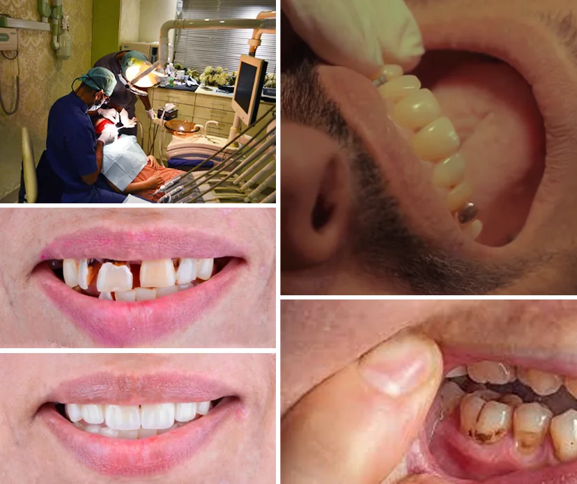 Exploring Pain in Teeth