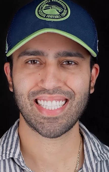 How Orthodontic Braces Treatment Improves Oral Health and Smile