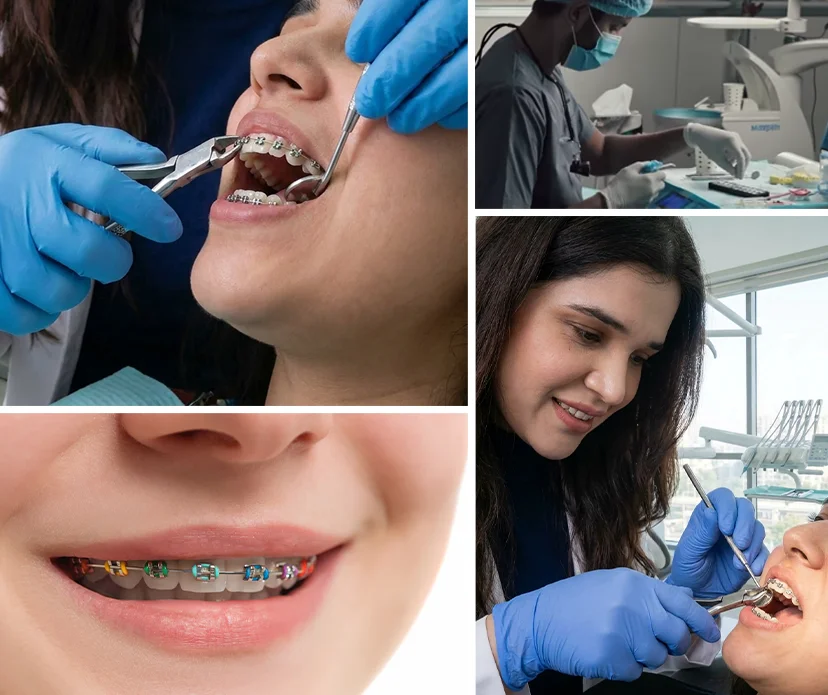 Insights on Orthodontic Specialist Care