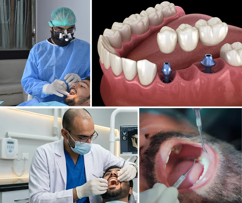 Insights on Prosthodontic Services 