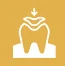 Large Tooth Fillings 