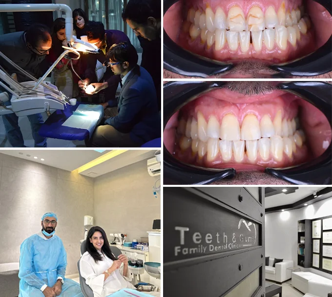 Why Patients Trust Teeth & Gums