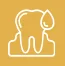 Bleeding-Gums