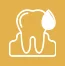 Bleeding or Swollen Gums 