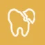 Cracked or Broken Tooth