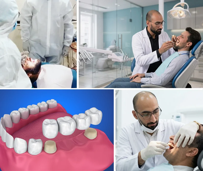 Exploring-Dental-Bridges