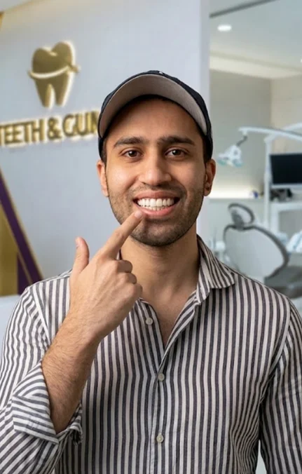 How Chipped or Broken Teeth Treatment Restores Your Smile