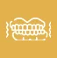 Overbite-(Class-2-Malocclusion)
