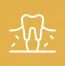 Receding-Gums
