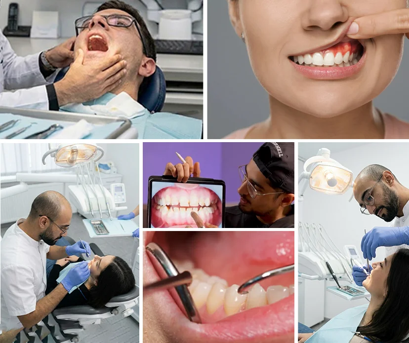 Understanding-Gum-Health-Maintenance