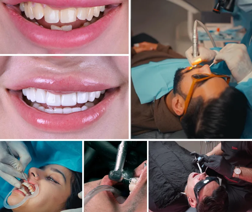 Understanding Teeth Whitening