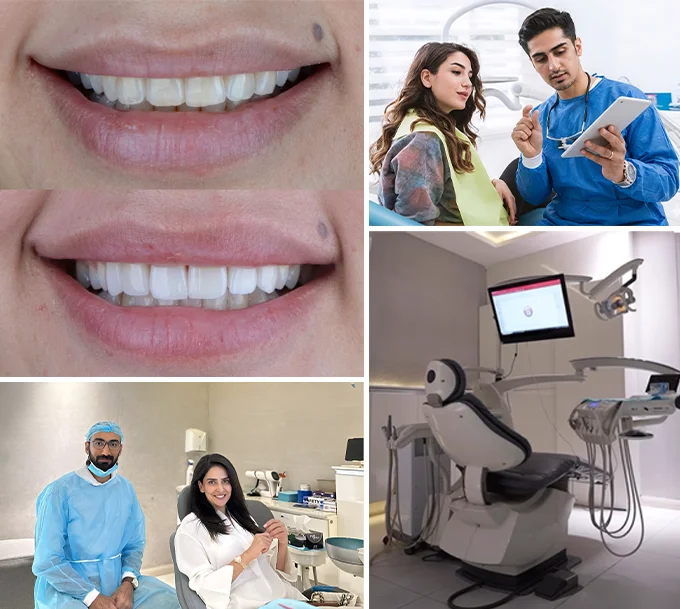 Why Patients Trust Teeth & Gums
