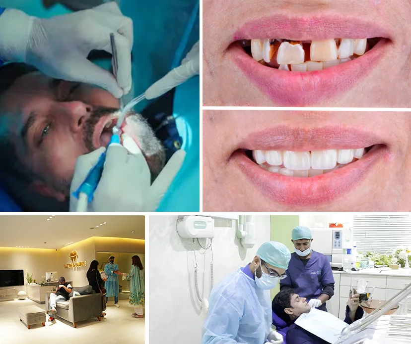 Why Patients Trust Teeth & Gums