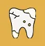 Yellow or Stained Teeth